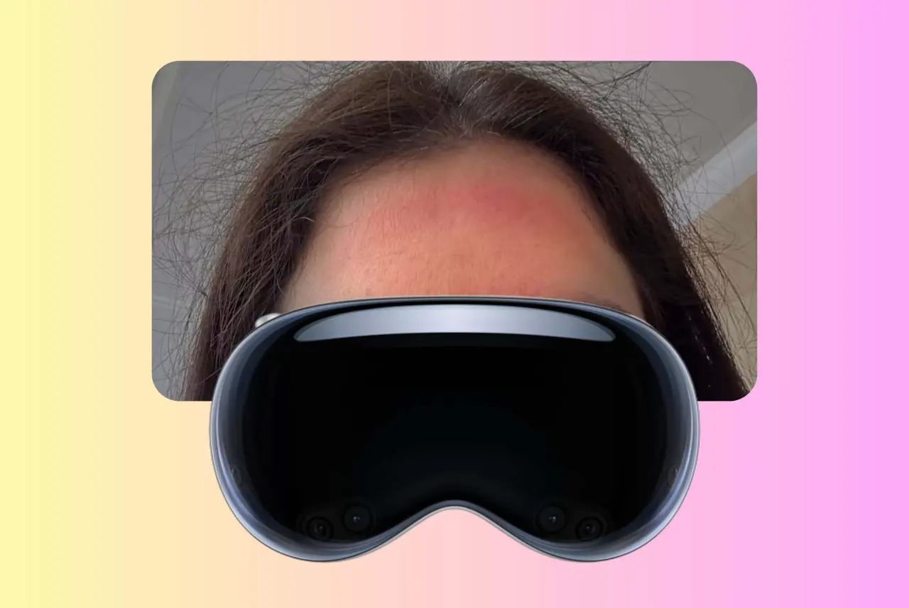 Apple Vision Pro, yüzde kızarıklığa neden oluyor